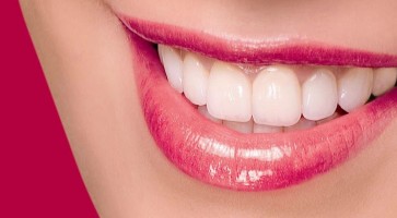 Sau khi bọc răng sứ có ngay ra tình trạng hôi miệng không?