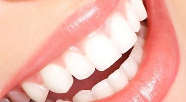 3 lợi ích cho bạn biết có nên bọc răng sứ không