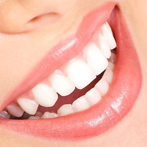 3 lợi ích cho bạn biết có nên bọc răng sứ không