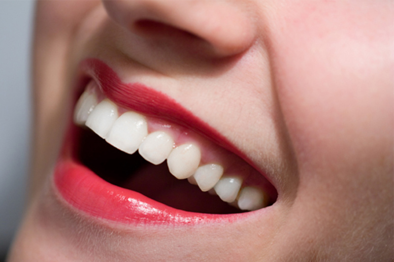 Trường hợp máu khó đông bọc răng sứ có tốt không?