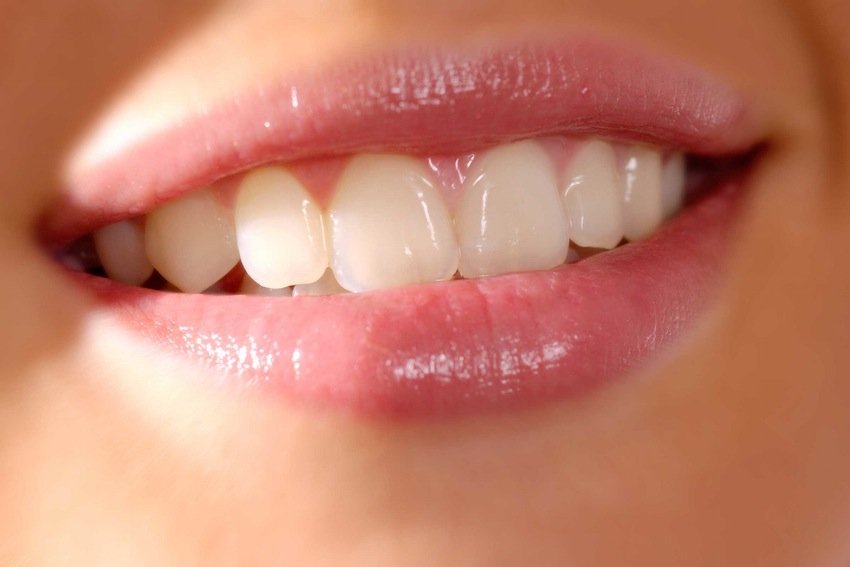 Những kiến thức cơ bản về bọc răng sứ