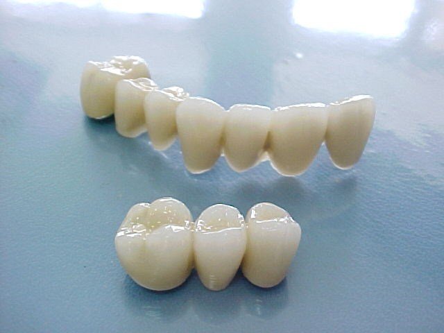 răng sứ nhật